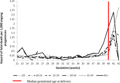 stillbirth risk by age